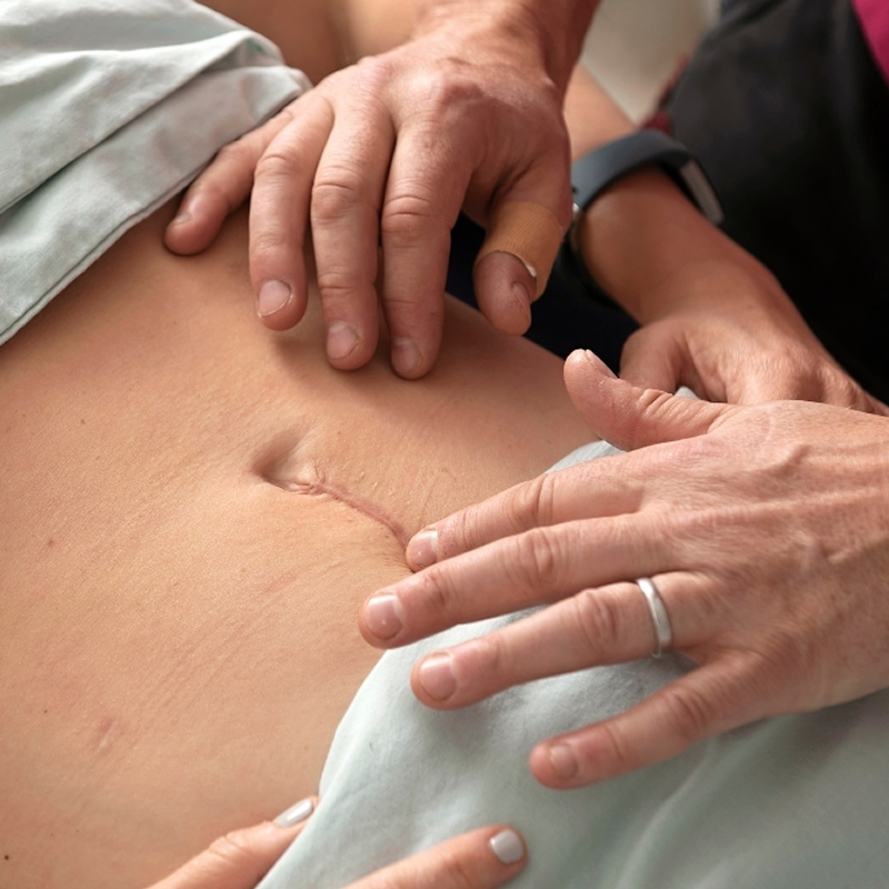 Terapia blizn - mobilizacja tkanek i praca manualna